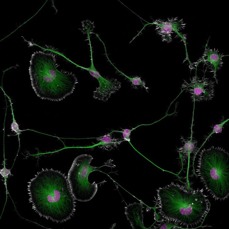 Mouse brain tumors Small World