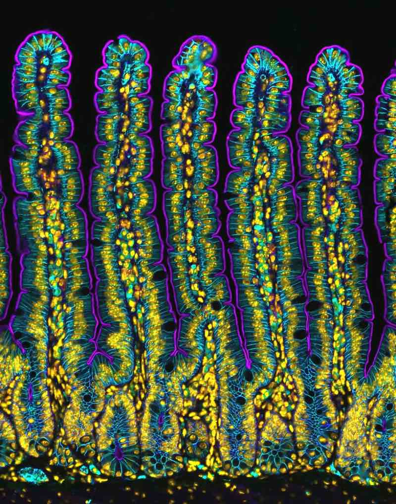 Intestines of mouse microscopic