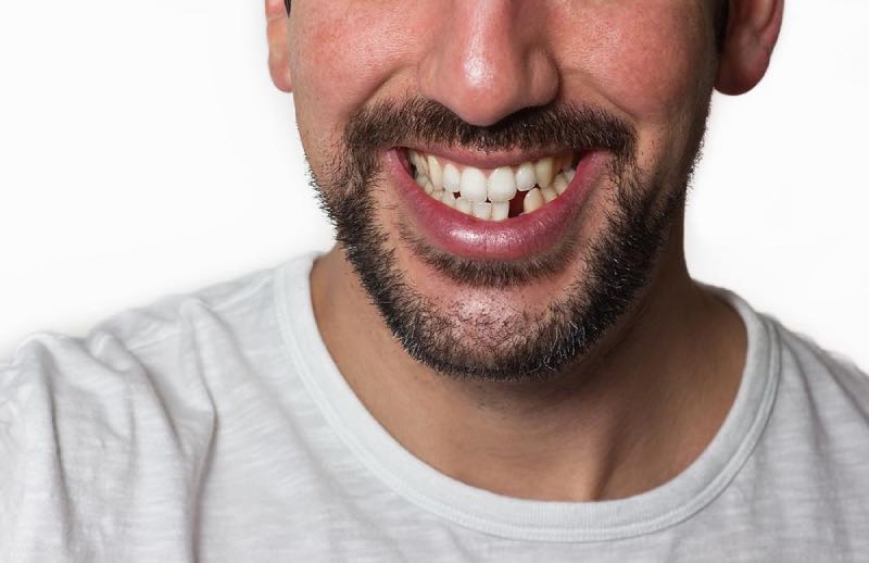 Man is missing one of his teeth 
