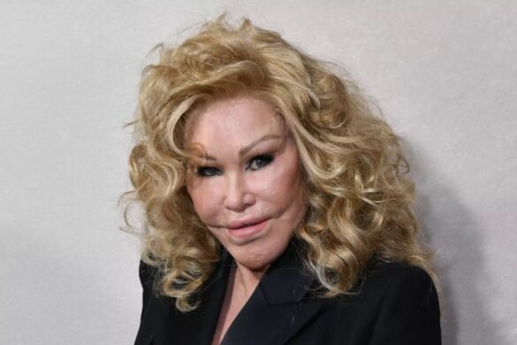 Jocelyn Wildenstein FT