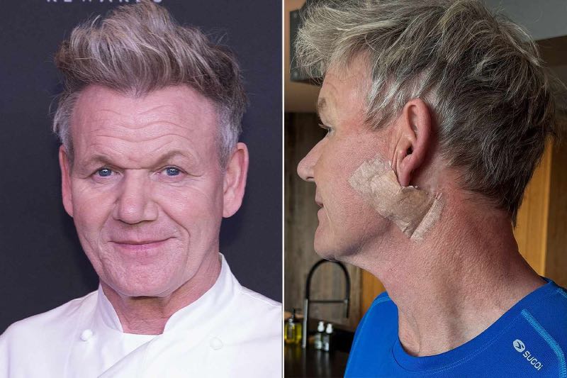 Gordon Ramsay