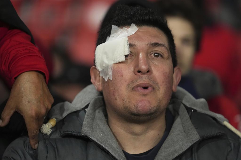 Independiente vs Universidad de Chile heridos