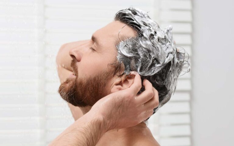champus hombre pelo graso