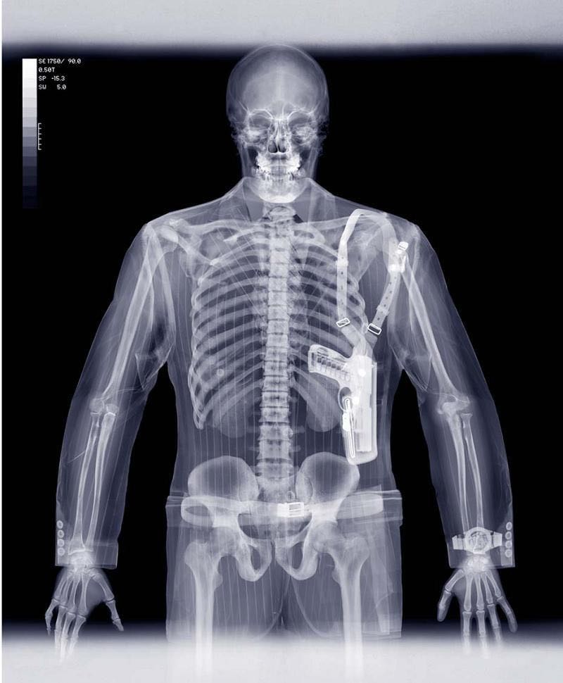 X-ray Visie
